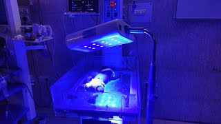Phototherapy Treatment For Jaundice | Phototherapy In Newborn