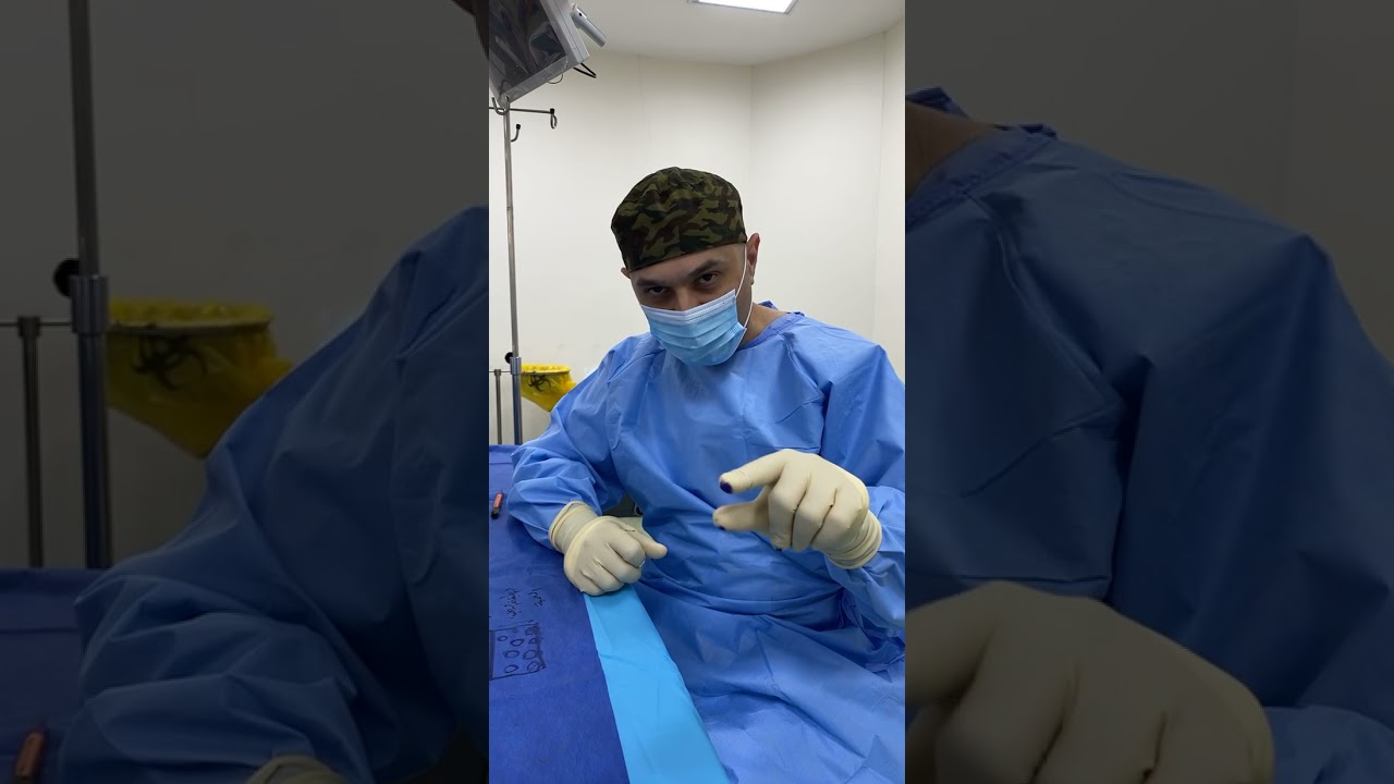 عملية حقن دهون في الوجه