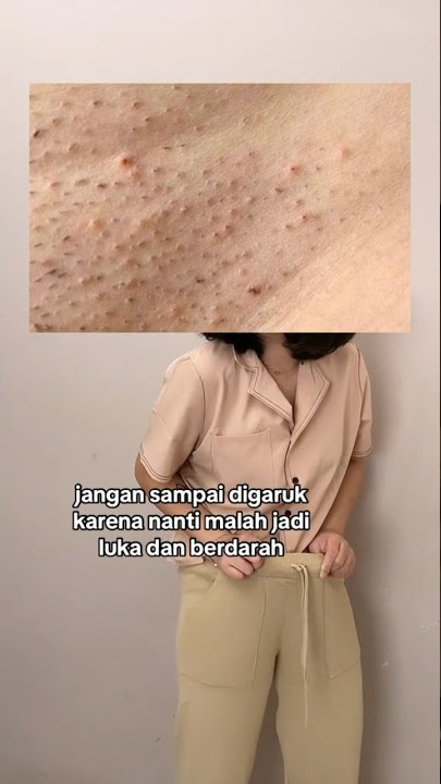 Gatal setelah cukur jembita #sugarpot #sugarpotwax #waxingmadeeasy #waxingtips