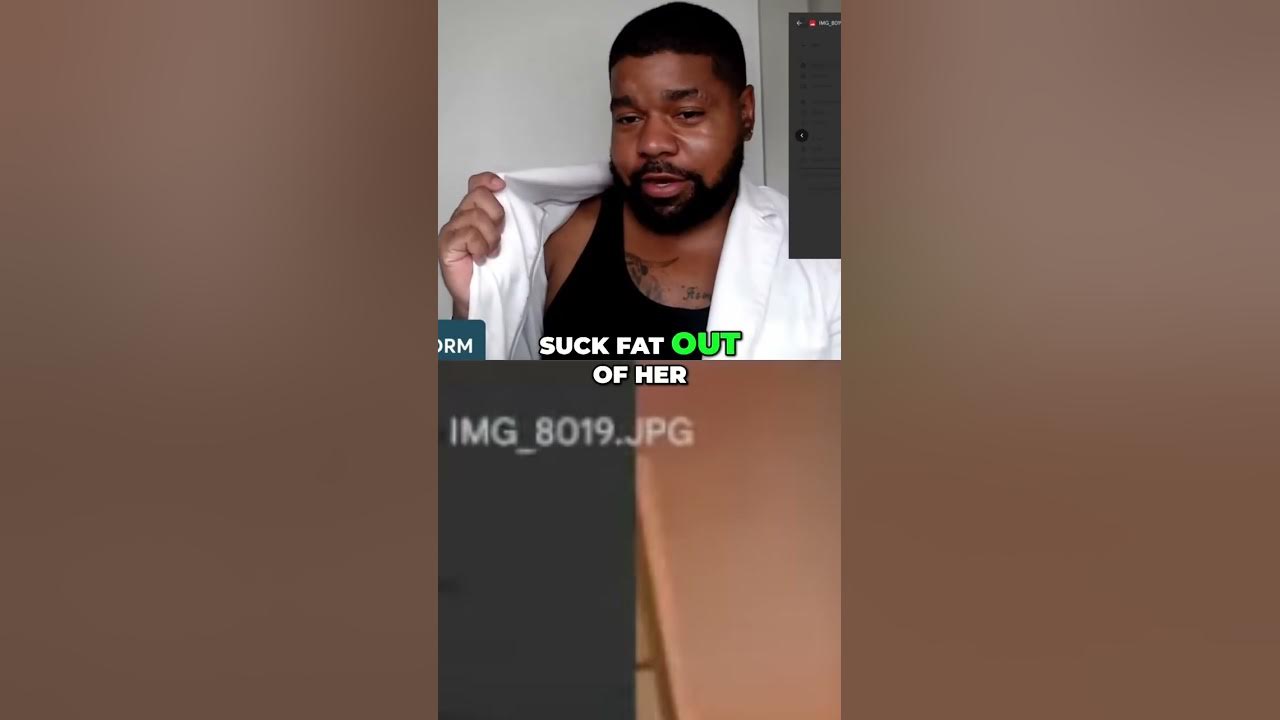 Rollie From Baddies Got A BBL but Kept Her Knocked-Knees! - YouTube