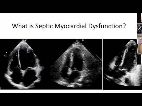 Cardiac Dysfunction in Sepsis