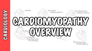 Cardiomyopathy Overview - types (dilated, hypertrophic, restrictive), pathophysiology and treatment