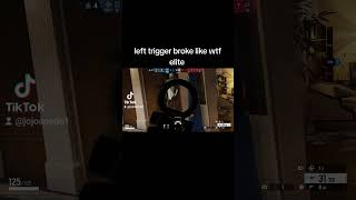 Elite xbox controllers suck