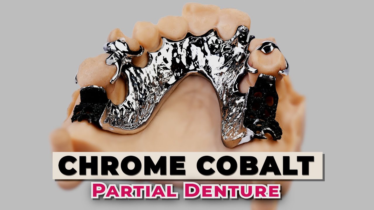 Chrome Cobalt Partial Denture