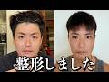 「親からもらった顔にメスを入れるなんて…」と否定派だった僕が、整形手術を決めた理由。