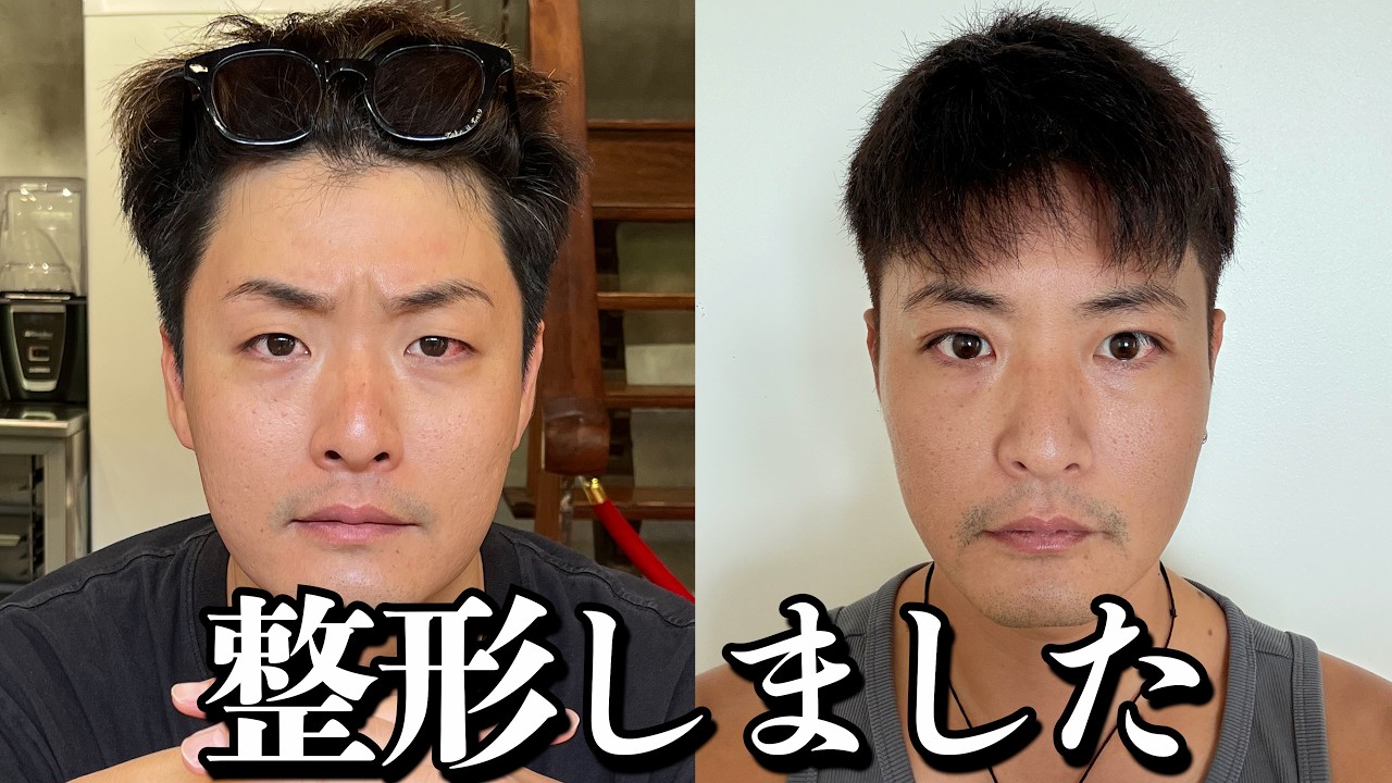 「親からもらった顔にメスを入れるなんて…」と否定派だった僕が、整形手術を決めた理由。