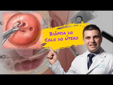 Vídeo: A agressão do colo é realmente uma coisa?