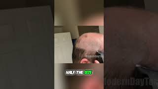 Manscape 4.0: Shaving My Head Experiment Goes VIRAL!
