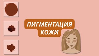 Пигментация кожи, витилиго, альбинизм, родинки, веснушки. Почему они появляются и что с ними делать?