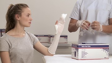 Delta Cast Soft Short Arm Cast Application - Astir