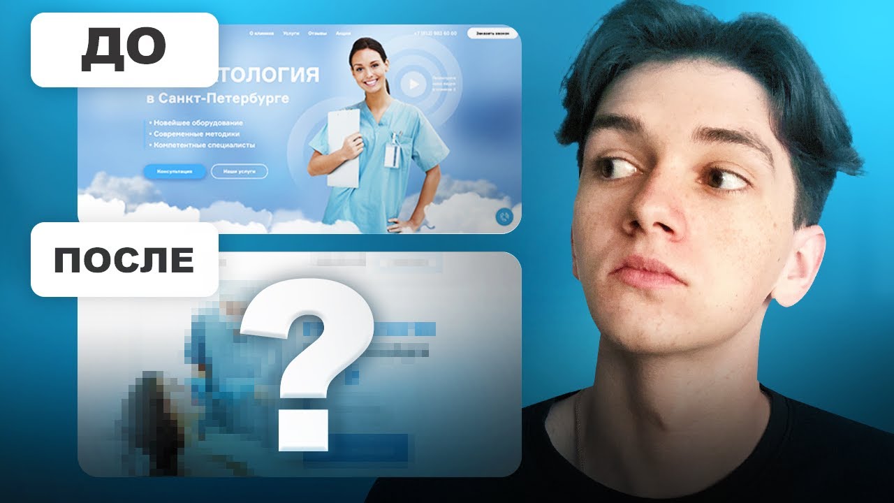 Дизайн ДО / ПОСЛЕ в ФИГМЕ для СТОМАТОЛОГИИ / Обновил экран лендинга