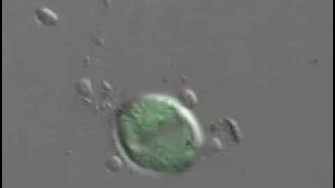 NK cell killing a cancer cell