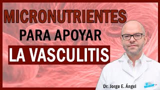 VASCULITIS Síntomas, Causas y Tratamiento (Dr. Jorge Ángel)