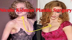 Nicole Kidman Plastic Surgery | Before and After Photos