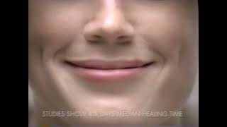 2005 Abreva Cold Sore Ointment