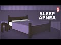 Sleep Apnea, CPAP, and Barriers to Care in the US
