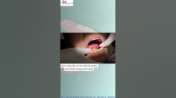 Hàm tháo lắp mới – vững vàng, tự tin, rạng rỡ hơn mỗi ngày! |cùng Nhakhoa Rangsu.vn