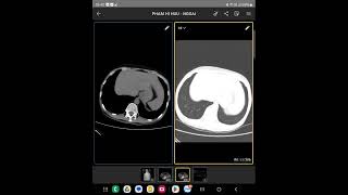 Hướng đẫn sử dụng phần mềm IDV DICOM VIEWER trên điện thoại và  máy tính