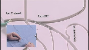 Angioplasty technique: Culotte stent (+English subtitle)