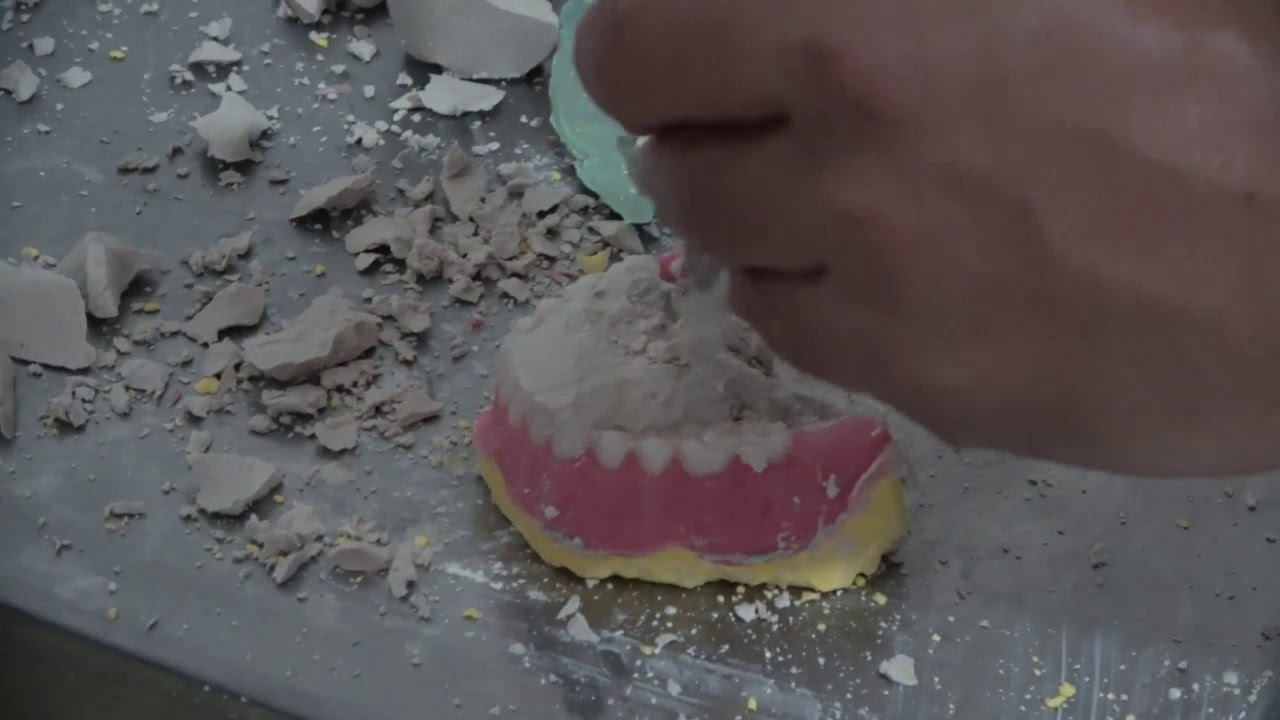 Mufla Açma - Prof. Dr. Hakan Akın