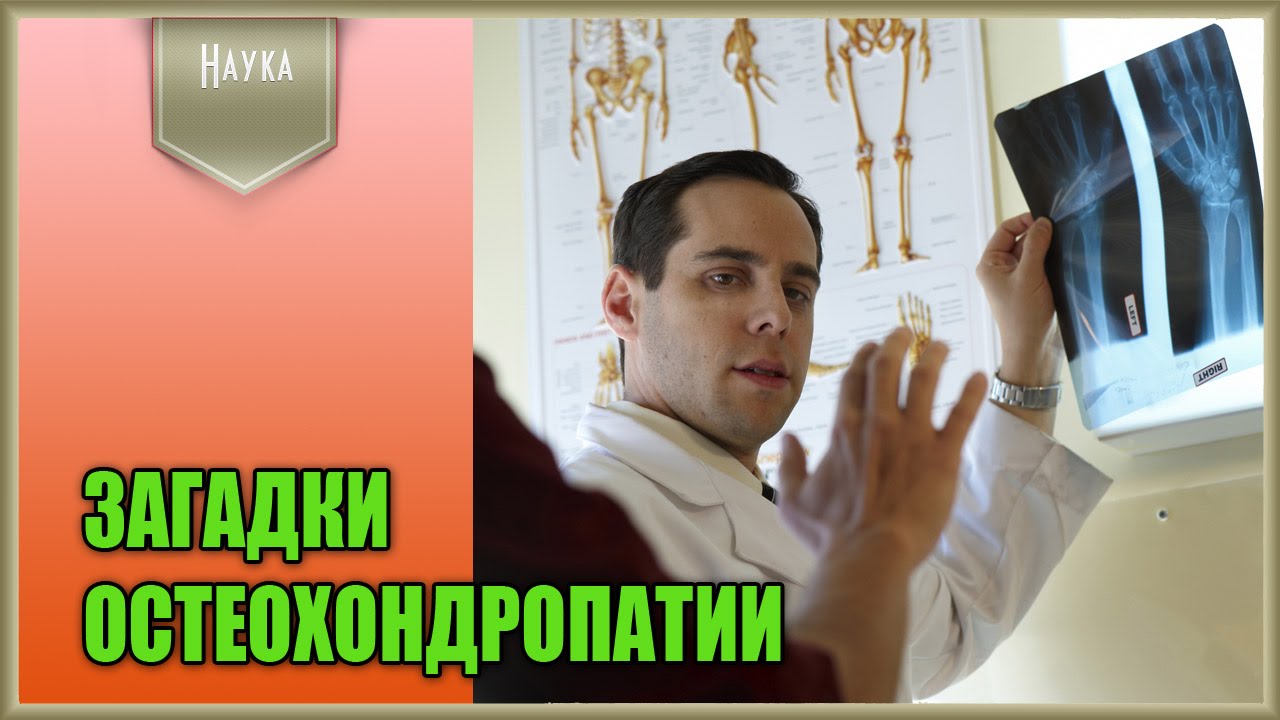Диагностика и лечение остеохондропатии у детей