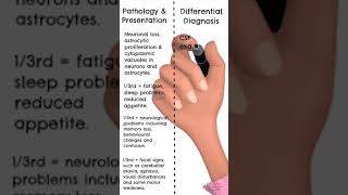 CJD Symptoms #educationalvideo  #cjd  #science #medschool #medstudent #premed #neurology