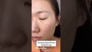 🔥How To Remove Open Pores At Home/Open Pores Home Remedy #shorts #openpores #skincare #youtubeshorts