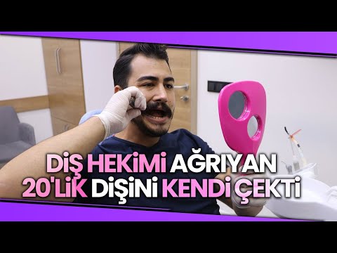 “Terzi Kendi Söküğünü Dikemez” Tarih Oldu, Diş Hekimi Ağrıyan 20'lik Dişini Kendi Çekti