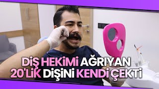 “Terzi Kendi Söküğünü Dikemez” Tarih Oldu, Diş Hekimi Ağrıyan 20'lik Dişini Kendi Çekti