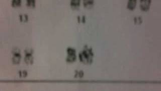 My Chromosomes Karyotypes and asking questions
