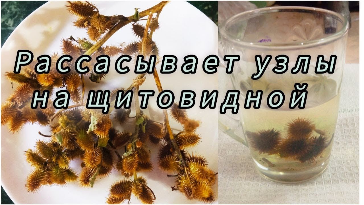 Дурнишник - источник йода Зоб Узлы на щитовидке Иммунитет Герпес