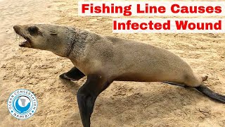 Fishing Line Causes Infected Wound