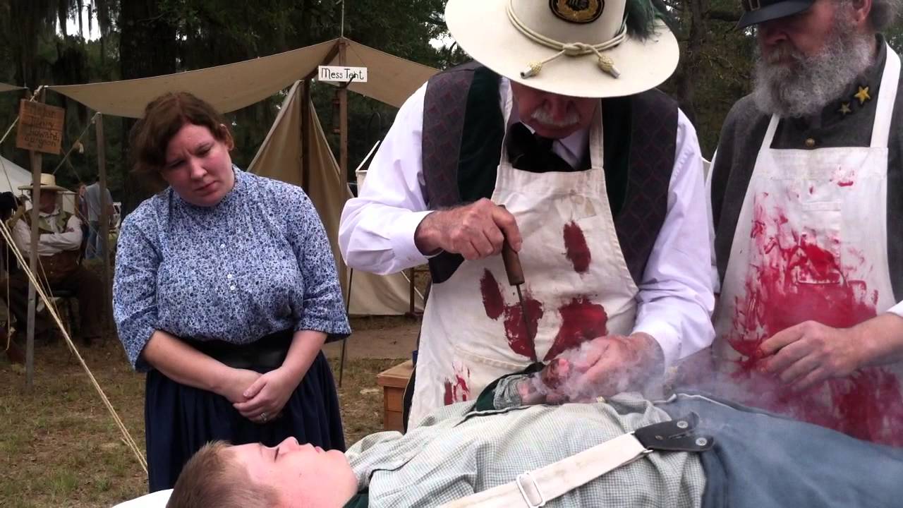 Civil War Amputation Demo