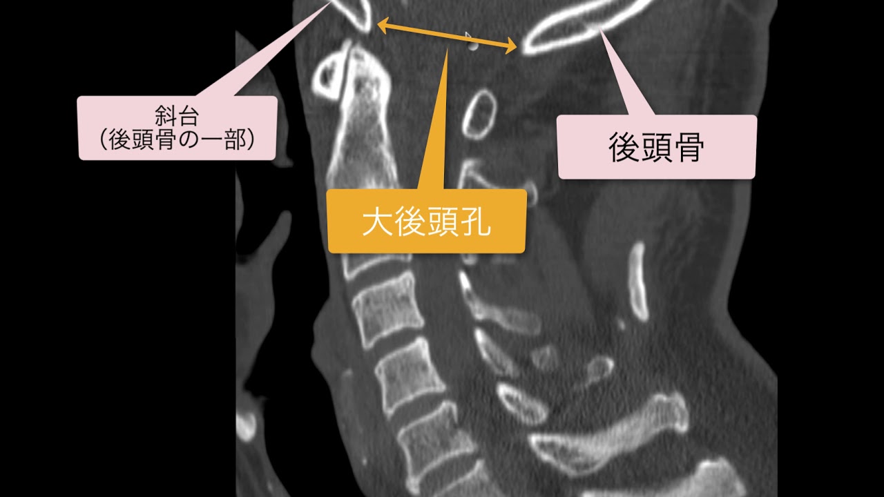 大 後頭 孔