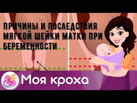 Причины и последствия мягкой шейки матки при беременности