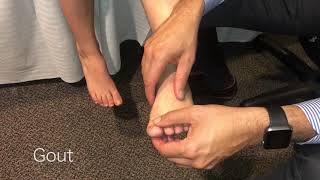 The Foot And Ankle Exam - Dr. Suraj Achar