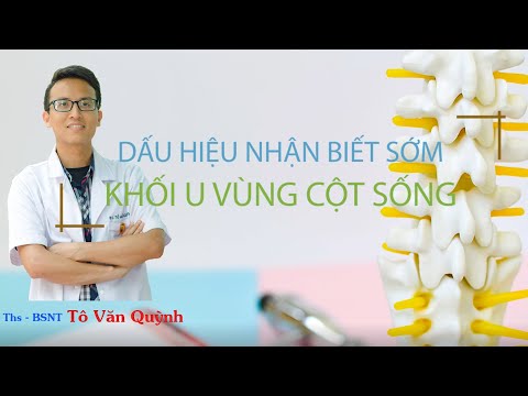 DẤU HIỆU NHẬN BIẾT SỚM KHỐI U VÙNG CỘT SỐNG