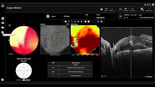 Quick Demo IXanner 7vn SW ver 1 5