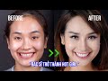 Chỉ dán sứ Veneer thôi, nữ bác sĩ đã trở thành HOT GIRL | White Dental