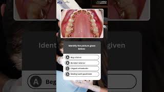 Challenge Quiz for #NEETMDS Aspirants | Comment Your Answers #dentistry #dentalstudents #mds