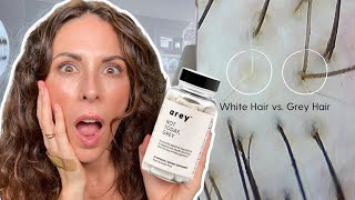 This MAGIC Vitamin ACTUALLY IS Repigmenting My Gray Hair (truly shocked)