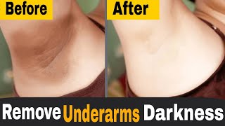 How To Lighten Dark Underarms at Home | Get Rid of Dark Armpits Naturally screenshot 4