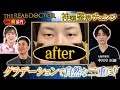 【二重切開法】グラデーション縫合で自然な二重に仕上げる大阪堺の神業ドクター #湘南美容クリニック