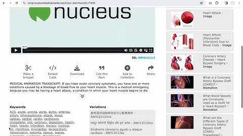 Viewing Content on the New Doe Report