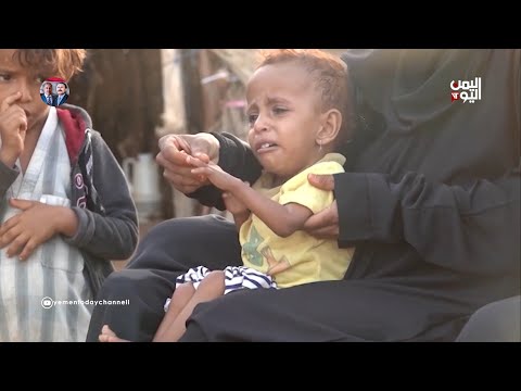 برنامج أممي ارتفاع الأسعار يدفع اليمنيين إلى الفقر المدقع 