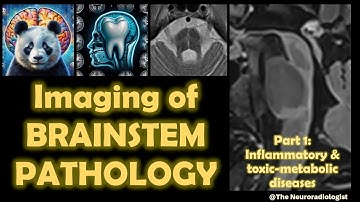 Imaging of Brainstem Pathology - Brainstem Encephalitis and beyond