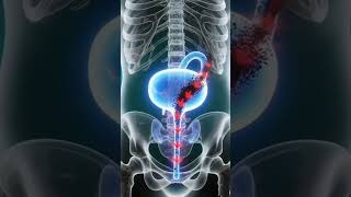 🔥बार-बार पेशाब में जलन और irritation से परेशान हैं? 😣#UrineInfection #UTI #HealthTips #HomeRemedy