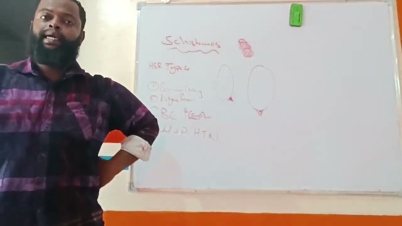 schistosomiasis (Bilharziasis) Dr.Ahmed Adlan