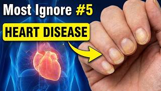 SENIORS: 9 Strange Signs of HEART DISEASE (Most Ignore #5)