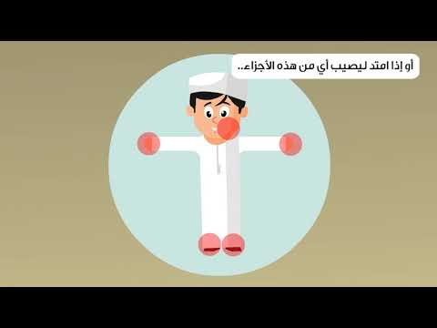 فيديو توعوي عن الحروق ضمن مبادرة في كل بيت مسعف